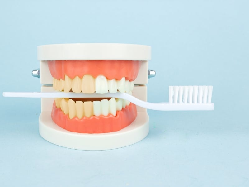 Dental model with one side whiter, toothbrush between teeth, demonstrating the effects of natural teeth whitening.