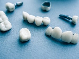 Multiple metal free implants and crowns displayed on a blue surface, highlighting dental restoration solutions.