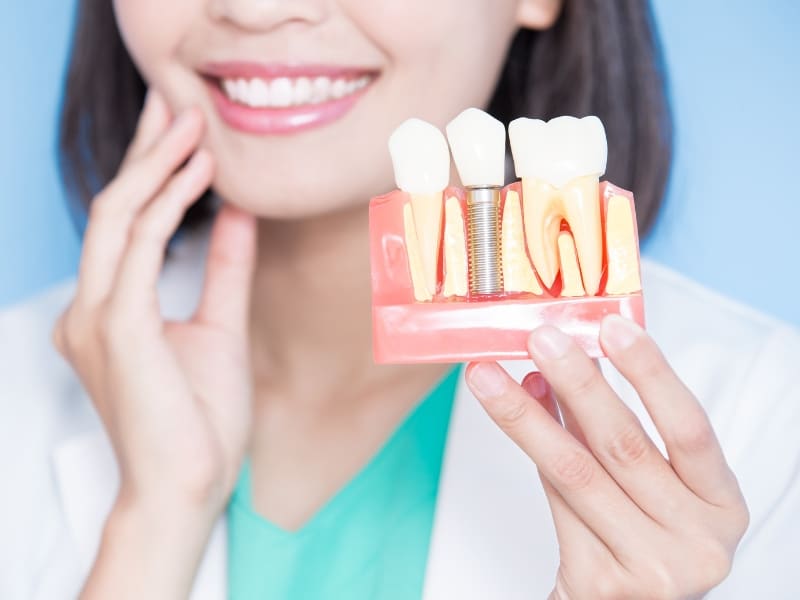 A dentist holding an artificial tooth with a dental implant, demonstrating different types of dental implants for patients.