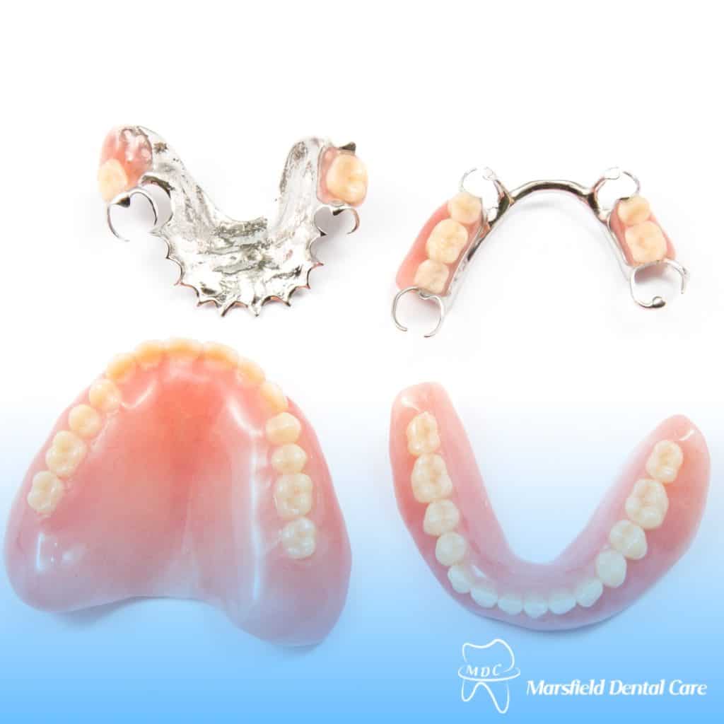 High-quality partial dentures, including flexible and metal-based designs, for upper and lower jaws. Custom dental prosthetics for tooth replacement.