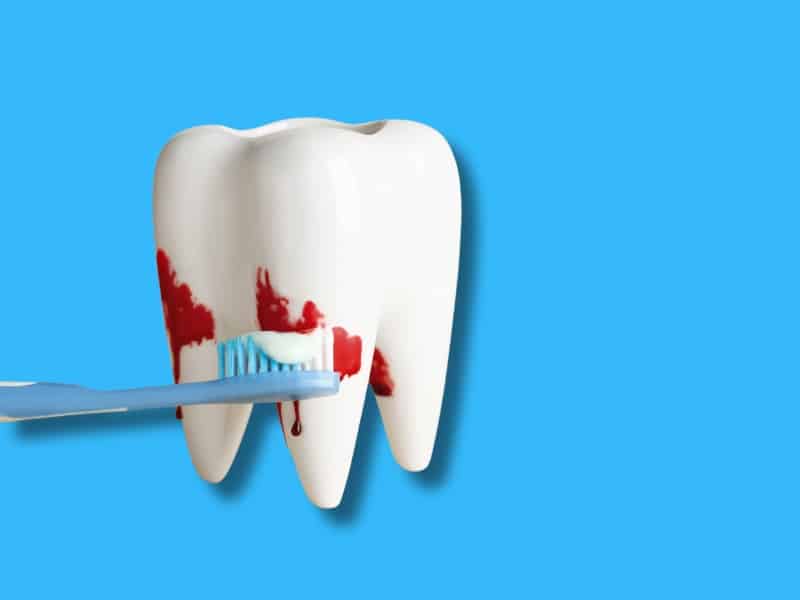 A toothbrush scrubbing a large tooth with visible blood, illustrating severe bleeding gums when brushing.