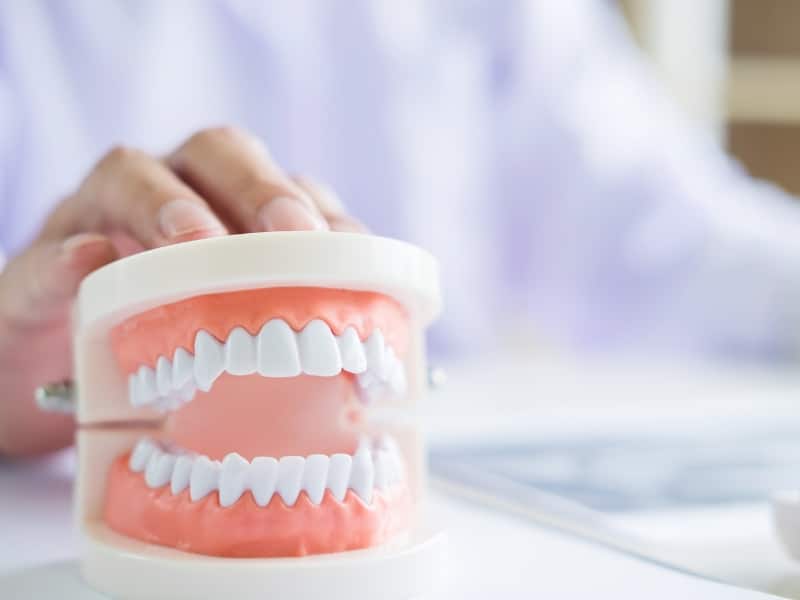 Dental model showing full dentures, illustrating denture discomfort solutions and the importance of well-fitted prosthetics.