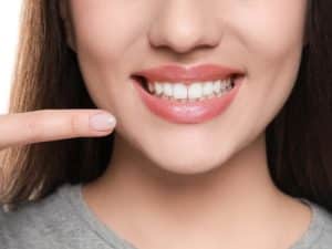 Smiling woman pointing at her teeth, indicating smoothness and shine after dental care. Avoiding reasons why teeth feel rough.