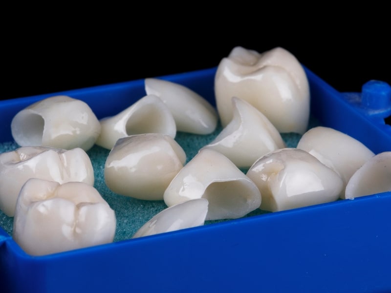 Dental crowns in a blue case showing wear, highlighting why do crowns need to be replaced.