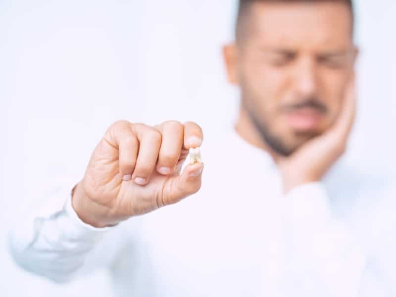 Man holding removed molar after wisdom tooth extraction with facial pain.