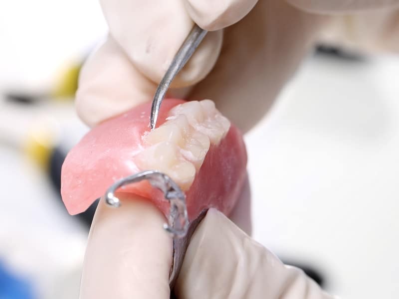Partial dentures repair with dental tool in gloved hands