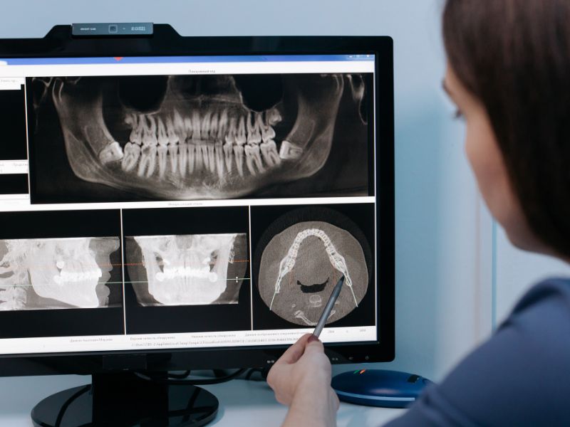 dental professional analysing digital scans after getting a dental xray