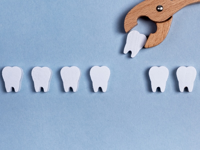 Wooden tool removing tooth figurine symbolising severe toothache pain leading to extraction.