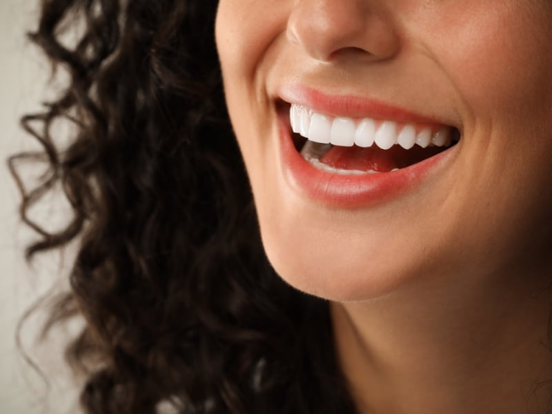 Close-up of a woman’s bright smile showing results from cosmetic dentistry treatments.