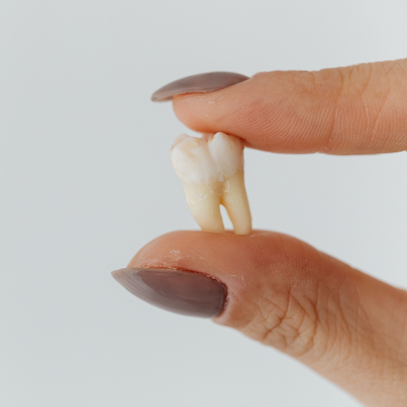 Extracted tooth held between two fingers against a plain background.
